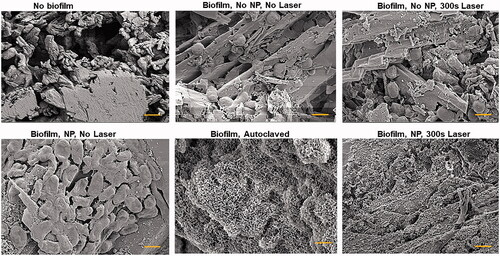 Figure 5. Scanning electron microscopy images of artificial kidney stones without biofilm or with biofilm and various nanoparticle treatments. Also included is a biofilm-coated stone that was autoclaved. All images were taken at 100,000× and the scale bar is 1 µm.