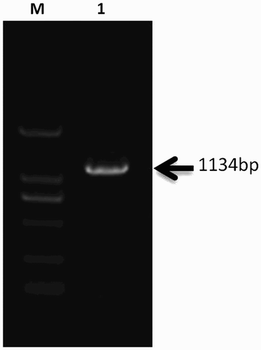 Figure 1. Gel electrophoresis of the PCR products of the IGFBP-6 gene 5'-terminus. M: DL2000 DNA marker; 1: IGFBP-6 gene 5'-terminus.