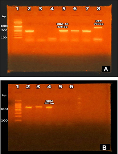 Figure 2 PCR results for carbapenemase genes. (A) Agarose gel electrophoresis of blaKPC and blaOXA-48 amplicons. Lane (1): DNA ladder 100 bp, lanes (2, 5, 6, 7): positive for blaOXA-48 gene (438bp), lane (8): positive for blaKPC gene (789bp). (B) Agarose gel electrophoresis of blaNDM amplicons. Lane (1): DNA ladder 100 bp, lanes (2–4): positive for blaNDM gene (621bp).
