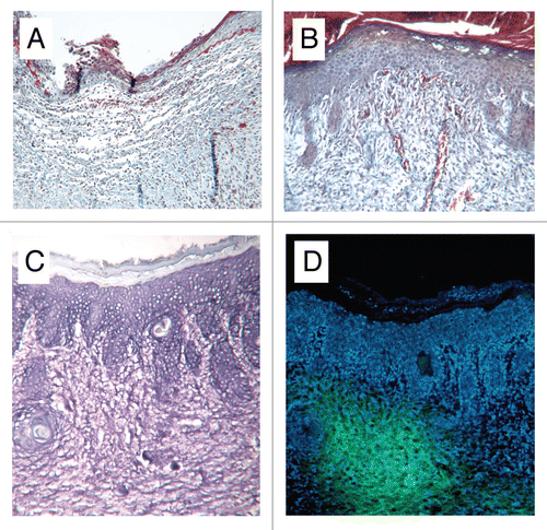 Figure 3 Photomicrographs of cryosections of (A) control and (B) HUCPVC-treated defects at 7 days showing incomplete re-epithelialization in the control and complete re-epithelialization in the HUCPVC specimen. Note the prominent microvasculature in (B). (C and D) show a pair of serial cryosections of a HUCPVC-treated defect at 7 days. (C) stained with Toluidine blue, shows the general tissue morphology with rete ridge formation, while the epifluorescent image in (D) shows the localization of the HUCPVC in the dermis. Field widths: (A and B) 2,144 µm, (C and D) 858 µm.