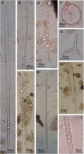Figure 2. A–G, Examples of sponge spicules and H,I, spicule fragments recorded in the sediment of the Posidonia matte. Some spicules can be easily recognised as A, strongyloxea of Tethya citrina or B, tylostyles of Cliona viridis. H,I, some fragments show deep marks of dissolution.