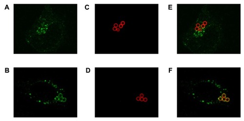 Figure 9 Intracellular location analysis of functionalized microparticles by CSLM. (A) Endosomal labeling with EEA-1. (B) Lysosomal labeling with LAMP-1. (C and D) Microparticles functionalized with an Alexa Fluor®-594 conjugated antibody. (E and F) Merged images of compartment and microparticles.Abbreviations: CSLM, confocal scanning laser microscopy; EEA-1, early endosome antigen 1 protein; LAMP-1, lysosome associated membrane protein 1.