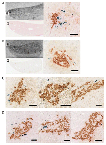 Figure 3. Histologic analyses of transplanted islets 1 wk after the islet transplantation and the counterpart MR images. (A) An example of insulin-stained islet which was co-stained with more than 10 Prussian blue-stained spots. Low power field histology and its counterpart MR image (left-hand side), and the high power field image of the area indicated by rectangle in the MRI and low power image (right-hand side). This example was from the recipient of control islets. (B) An example of insulin-stained islet which was co-stained with less than 10 Prussian blue-stained spots (right-hand side). Low power field histology and its counterpart MR image (left-hand side), and the high power field image of the area indicated by rectangle in the MRI and low power image (right-hand side). This example was from the recipient of PEGylated islets. (C) Representative high power field images of control islets. (D) Representative high power field images of PEGylated islets. Scale bars indicate 50 μm in each figure (A–D).