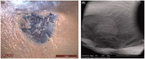 Figure 3. (A) Fracture surface of MC crown (nr 14) at 30 × magnification (light microscopy); (B) Fracture surface of MC crown (nr 14) at 44 × magnification (SEM).