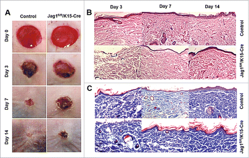 Figure 3. ESC-conditional knockout of Jag1 promoted scar formation. (A) Representative wound images, (B) Representative H&E staining, (C) Representative Masson staining. N = 10 mice/group.
