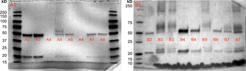 Figure S1 Representative SDS-PAGE gel, showing trastuzumab engraftment on liposome surface. Protein markers (A1), trastuzumab (A2), thiolated trastuzumab (A3), Liposome-1 (A4), ANC-1 engrafted with strategy B (A5), Liposome-1 engrafted with strategy B without maleimide function (A6), ANC-1 engrafted following strategy A (A7), Liposome-1 engrafted following strategy A without maleimide function (A8), protein markers (B1), trastuzumab (B2), ANC-1 engrafted following strategy B (B3), Liposome-1 engrafted following strategy B without maleimide function (B4), ANC-2 engrafted with strategy B (B5), Liposome-2 engrafted with strategy B without maleimide function (B6), ANC-1 engrafted with strategy B after 45 days (B7).Abbreviations: SDS-PAGE, sodium dodecyl sulfate polyacrylamide gel electrophoresis; ANC, antibody nanoconjugate.
