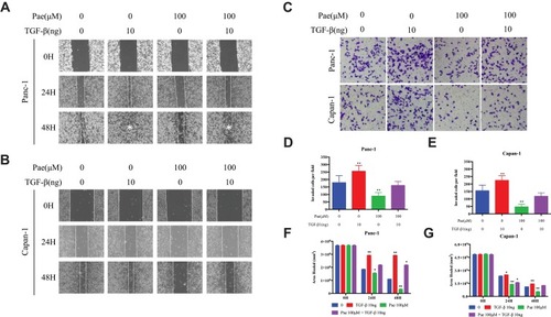 Figure 4 Paeonol attenuated the migration-promoting ability of TGF-β1. (A, B) Scratch wound-healing assay. Cell migration of Panc-1 and Capan-1 cells treated with or without Paeonol (100μΜ) and with or without TGF-β1 (10ng) for 48 hrs was assessed by restoring scratches and comparing with the area of the initial scratch (magnification: 100x); (C) The effects of Paeonol (100μΜ) treated with or without TGF-β1 (10ng) for 48 hrs on Panc-1 and Capan-1 cells migration were examined using chamber assays (magnification: 40x); (D, E) Histogram, based on five random fields of three independent experiments selected for statistical analysis, showed the number of invaded cells; (F, G) Histogram, based on Panc-1 and Capan-1 cell migrations were assessed by restoring scratches and the repair of the initial scratched area. All results are representative of three independent experiments. *P<0.05, **P<0.01, as compared with the non-treated control group.