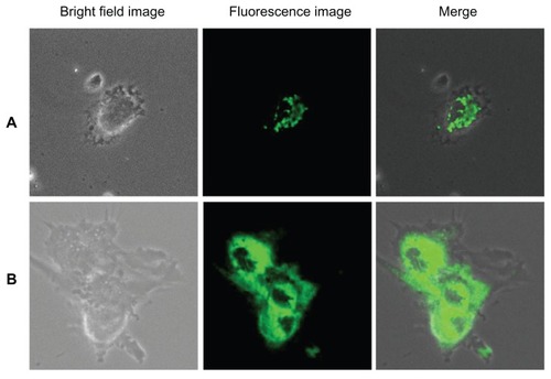 Figure 10 Imaging of (A) human umbilical vein endothelial cells and (B) glioma cells using cadmium sulfide quantum dots after 1 hour of incubation.