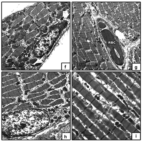 Figure 11. Transmission electron micrographs of skeletal muscle in 21-day-old rat. High fat diet with (f & g) barley and (h & i) fenugreek grains supplementation showed improvement in muscle fibers and nucleus with peripheral arrangement of heterochromatin and showed abundant mitochondria in between muscle fibers, glycogen granules, blood vessel and red blood cell. Abbreviation: M, mitochondria; N, nucleus; nu, nucleolus; BV, blood vessel; RBC, red blood cell; G, glycogen granules.