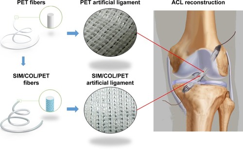 Figure 1 Schematic illustration of PET artificial ligament and collagen/simvastatin microspheres coating on PET in the artificial ligament anterior cruciate ligament (ACL) reconstruction.Abbreviations: PET, polyethylene terephthalate; SIM/COL/PET, collagen and simvastatin microspheres collagen coating on polyethylene terephthalate fibers.