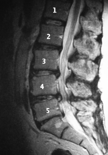 Figure 1. Preoperative evaluation using MRI.