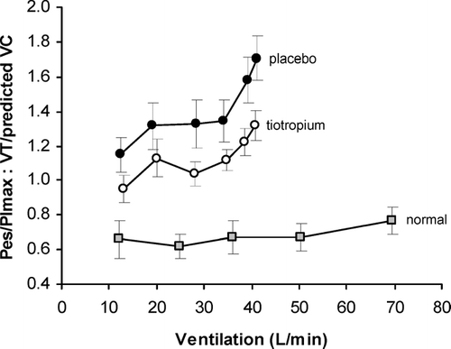 Figure 8 The ratio between respiratory effort (Pes/PImax) and tidal volume displacement (VT standardized as a fraction of predicted vital capacity (VC)), an index of neuromechanical dissociation, is shown during exercise after tiotropium and placebo in COPD (n = 11) compared to a previously studied group of age-matched normal subjects (n = 12). The effort-displacement ratio is increased in COPD compared with normal throughout exercise, with an upward trend after a ventilation of approximately 30 L/min that did not occur in the normal subjects. Compared with placebo, tiotropium reduced this ratio throughout exercise in COPD. From O'Donnell DE, Hamilton AL, Webb KA. J Appl Physiol 2006; 101: 1025-1035, with permission.