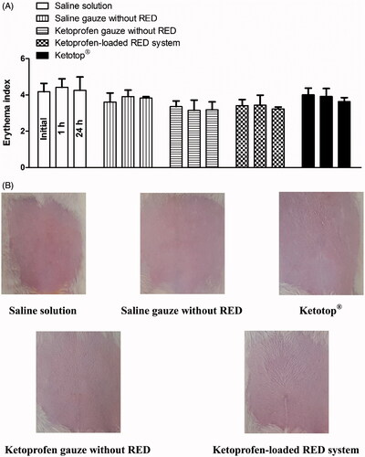 Figure 6. Erythema indices of skin at 0, 1, and 24 h (A) and its photographs at 24 h (B) after the transdermal application of saline solution, saline-soaked gauze dressing without the RED system (Saline gauze without RED), ketoprofen-soaked gauze dressing without the RED system (Ketoprofen gauze without RED), ketoprofen-loaded RED system, and Ketotop® patch without the RED system (Ketotop®) in rats. The rectangular bars and their error bars represent the means and standard deviations (n = 3–4).
