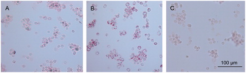 Figure 5. Oil red O stain of macrophages incubated with RPT–heLDL. Magnification ×200. (A) 100 µg/mL RPT–heLDL. (B) 200 µg/mL RPT–heLDL. (C) 2% serum (negative control).