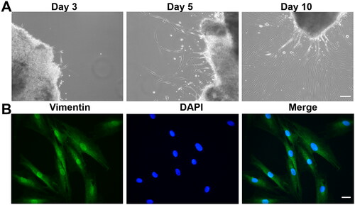 Figure 4. Characterization of primary HTFs. (A) Representative phase-contrast images of HTFs on days 3, 5 and 10. Scale bar: 100 μm. (B) Cells were stained with anti-vimentin antibodies and DAPI. Scale bar: 10 μm.