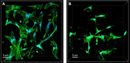Figure 6 CLSM images of cytoskeletal morphology of the MG63 cells cultivated on n-BPC (A) and PCL–PEG–PCL (B) scaffolds for 5 days.Abbreviations: CLSM, confocal laser scanning microscopy; n-BPC, n-BD/PCL–PEG–PCL composite; n-BD, nanobredigite; PCL–PEG–PCL, poly(ε-caprolactone)–poly(ethyleneglycol)–poly(ε-caprolactone).