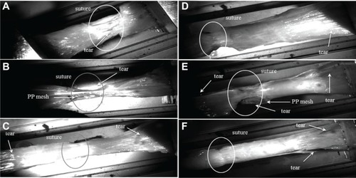 Figure 3A–F Video-recorded biomechanical assay (tensile strength).Notes: (A) Simple suture tears in the line. (B) Healthy muscle broke at the edge, and the PP mesh slid on the top of the muscle. (C) Tissue treated by a PP mesh functionalized with PCL nanofibers enriched with adhered GF tore at the edge of the mesh and healthy muscle, and the slide was localized between muscle fibers. (D) In some PCL-nanofiber samples with adhered GF, the suture line tore first, but in others a tear occurred between muscle fibers or at the edge of the muscle and the mesh. (E) Healthy muscle tore at the edge, and a PP mesh functionalized with PCL nanofibers slid on top of the muscle, or the tear was localized not between the mesh and the muscle layer but in between muscle fibers. (F) In some PCL-nanofiber samples, the suture line tore first, but in others a tear occurred between muscle fibers or at the edge of the muscle and the mesh. White circles indicate areas of regenerated incision.Abbreviations: PP, polypropylene; PCL, poly-ε-caprolactone; GF, growth factor.