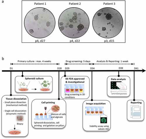 Figure 1. Representation of the micropillar-based drug screening workflow for personalized functional profiling. (a) Representative pictures of tumor spheroids. The tumor specimens were obtained from patients 1, 2 and 3 (see Table 1). The images show the spheroids on the indicated passages (p) and days (d) after plating of the original tumor material in ultra-low attachment dishes. The pictures were taken one to 2 days after cell passaging. (b) The tumor biopsy is mechanically and enzymatically dissociated into a single-cell suspension and put in culture for spheroid formation. After maximum 4 weeks, the spheroids are dissociated into single cells and small cell clusters which are dispensed together with the alginate matrix onto a 384-pillar plate using an ASFA Spotter ST (Medical and Bio Decision , South Korea). The pillar plate is then “stamped” with the 384-well plate containing the spheroid growth medium. After one day in culture, the cells are challenged by a panel of 66 FDA-approved or investigational drugs in a fourfold and seven-point serial dilution series from 30 μM to 7.3 nM in duplicates. Cell viability is assessed by calcein AM live cell staining after a 5 day-incubation with the drugs. The IC50 and DRC are generated and the AUC is calculated. The patient’s data are then compared to data from other patients to determine the AUC z-score. The treatment is selected as a hit drug for the patient if z-score < −1. The drug screening results are reported to the medical staff approximately 6 weeks after tissue sampling.In panel a, tumor spheroids from 3 patients at different passages and days after cell plating, showing their good propagation in culture. In panel b, steps of a micropillar-based personalized functional profiling, including tissue dissociation, spheroid culture, cell printing in alginate drops, drug screening, image acquisition of calcein AM green fluorescence in live cells, data analysis and report generation.