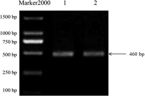 Figure 1. Bacterial PCR electrophoresis map. The bands in lanes 1 and 2 are bright and clear, there is no smear in the lanes, and the band size is in line with the target.