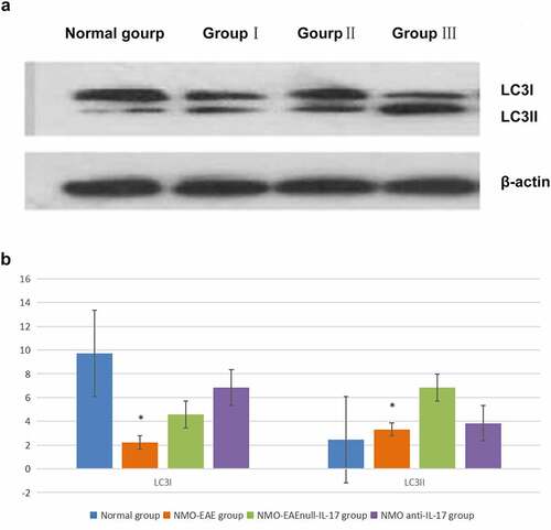 Figure 3. Expression of LC3I and LC3II proteins in each group. (a): Western blot of LC3I and LC3II proteins expression in each group. (b): Statistical difference of LC3I and LC3II proteins expression in each group.