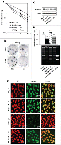 Figure 6. The 5-Aza-mediated induction of TOPO2A reduces the survival of Hep-2 and RR-Hep-2 cells and increases TOPO2A activity. (A) Hep-2 and RR-Hep-2 cells were treated with or without 5-Aza (5 μM), and clonogenic survival fractions were determined following exposure to the indicated doses of radiation. (B) RR-Hep-2 cells were treated with 5-Aza (5 μM) and then further treated with or without 4-Gy irradiation. Colony formation was visualized by trypan blue staining. (C) The protein levels of TOPO2A were determined by Western blotting; β-actin was employed as the loading control. (D) TOPO2A decatenation activity was measured in nuclear extracts from Hep-2 and RR-Hep-2 cells treated with or without 5 μM of 5-Aza for 72 h. (E) Hep-2 and RR-Hep-2 cells were treated with or without 5-Aza (5 μM) for 72 h and fixed with 4% (v/v) paraformaldehyde. Cells were stained for TOPO2A using an FITC-conjugated secondary antibody, and propidium iodide (PtdIns) was used to visualize nuclei. Panels: (a, d, g, and j) PI (red) staining; (b, e, h, and k) localization of TOPO2A (green); and (c, f, i and l) merged images of TOPO2A and PtdIns. The data presented represent a typical result or average values with standard deviations from 3 independent experiments. *P < 0.05.