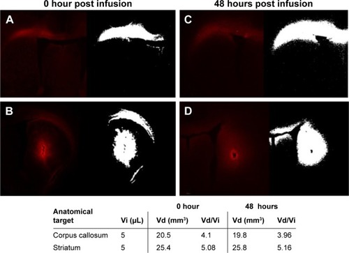 Figure 4 Distribution of P407-rhodamine nano-micelles after CED into rat corpus callosum (white matter) and striatum (gray matter).Notes: (A) White matter distribution 0 hour after CED. (B) Gray matter distribution 0 hour after CED. (C) White matter distribution 48 hours after CED. (D) Gray matter distribution 48 hours after CED. Volume of infusion (Vi) is calculated by auto-segmentation of fluorescent signal (white image) from images from adjacent 35 μm brain sections using bespoke in-house software. Volume of distribution to volume of infusion ratio (Vd/Vi) indicates bulk flow of micelles via CED rather than simple injection.Abbreviations: CED, convection enhanced delivery; P407, poloxamer 407.