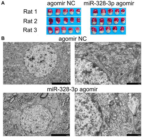 Figure 3 Influence of miR-328-3p on I/R injury in rats. (A) After reperfusion, TTC staining of representative coronal sections at 24 h was analyzed (n=3, each group). (B) Ultrastructural changes induced by I/R injury. In the agomir NC group, the neuron cells were round, the double-layer structure of the nuclear membrane was clear, the local area of the cell membrane was blurred, the intracellular organelles were slightly swollen, and the cytoplasmic electron density was high. The nucleus was oval, the nuclear membrane was clear, and the nuclear pores were clearly visible. Mitochondria were more evenly distributed, but slightly swollen and expanded, with a small number of ridges breaking and disappearing. Rough endoplasmic reticulum was mostly slightly expanded, with no obvious degranulation on the surface ribosome. The smooth endoplasmic reticulum was slightly expanded. The Golgi body was normal and might be functionally expanded. A small number of secondary lysosomes (SL) were present. However, in the miR-328-3p agomir group, the cell morphology was roughly oval, the cell membrane was partially obscured, the organelles were moderately edema, the cytoplasmic electron density was reduced, and the cytoplasm was slightly edema. The nucleus was oval and shrunk. The nuclear membrane was partially blurred, and the nuclear pores were not visible. Mitochondria were evenly distributed, and mostly moderately swollen, the matrix was slightly uneven, and the ridge was broken. The rough endoplasmic reticulum was slightly expanded, with no obvious degranulation on the surface ribosome. Golgi was expanded.