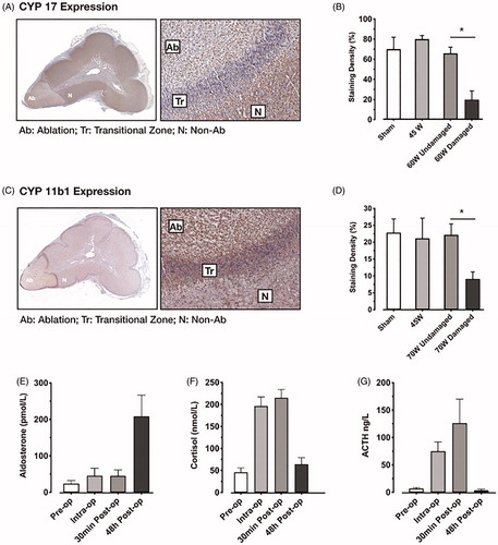 Figure 4. (A) Immunohistochemistry images of expression of the steroidogenic enzyme CYP17 in adrenal gland exposed to high MTA dose. There is an absence of normal cytoplasmic expression of CYP17 in ablated [Ab] tissue as compared to non-ablated tissue [N], and this was sharply delineated by the transitional zone [Tr]. (B) Staining density for CYP17 was markedly reduced within the ablation zone of tissue exposed to high MTA dose (70 W damaged) as compared to sham, low MTA dose (45 W) and non-ablated tissue (70 W undamaged). (C) Immunohistochemistry images of expression of the steroidogenic enzyme CYP11B1 similarly showed disruption of normal cytoplasmic expression in [Ab] tissue as compared to non-ablated tissue [N], and this was also sharply delineated by the transitional zone [Tr]. (D) Staining density tor CYP11B1 was also reduced within the ablation zone of tissue exposed to high MTA dose (70 W damaged) as compared to sham. Low MTA dose (45 W) and non-ablated tissue (70 W undamaged). The immunohistochemical findings are consistent with blood biochemistry which demonstrated appropriate levels of aldosterone (E), cortisol (F) and stimulatory ACTH (G) at 48 h post-operatively. Staining density expressed as percentage (%); ACTH, adrenocorticotrophin; *p < .01 compared with damaged tissue (ANOVA with Tukey's post-hoc test).