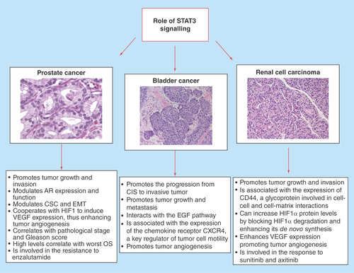 Figure 1.  Role of STAT3 in genitourinary tumors.AR: Androgen receptor; CIS: Carcinoma in situ; CSC: Cancer stem cell; EMT: Epithelial–mesenchymal transition; OS: Overall survival.