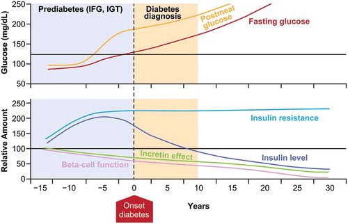 Figure 1. Natural history of type 2 diabetes. IFG, impaired fasting glycemia; IGT, impaired glucose tolerance. Mazze R, et al., Staged diabetes management: a systematic approach. 2nd Ed. John Wiley & Sons. Copyright © 2006 Matrex