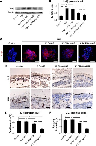 Figure 7 Effect of HGF-loaded SAP/Hep gel on inflammation of β-cell.Notes: (A, B) Western blot and quantitative analysis of IL-1β protein level in vitro. (C) Immunofluorescence (IF) staining for IL-1β in vitro (scale bar =50 μm). (D) IHC staining for IL-1β and CD3 in vivo (scale bar =50 μm). Quantitative analysis of (E) IL-1β protein and (F) CD3+ T lymphocytes in vivo as determined by IHC staining. Data are mean ± SD. *P<0.05; **P<0.01. 200× magnification.Abbreviations: K, lysine; L, leucine; D, aspartate; R, arginine; HGF, hepatocyte growth factor; SAP, self-assembling peptide; Hep, heparin; IHC, immunohistochemistry; TNF, tumor necrosis factor; IL, interleukin.