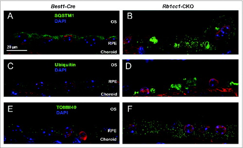 Figure 10. Loss of autophagy in the RPE results in accumulation of intracellular debris. The Rb1cc1-CKO mice had a significant accumulation of SQSTM1 (A, B) and ubiquitin-tagged debris (C, D) within the RPE, as well as increased accumulation of mitochondria (E, F), as compared to littermate controls. These findings are consistent with decreased autophagy flux in these cells. OS, outer segment; RPE, retinal pigment epithelium.