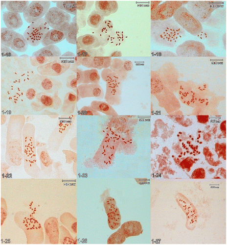 Figure 1. (Continued) 1-16, Jurinea kopetensis 2n = 34; 1-17, J. radians 2n = 34; 1-18, J. monocephala subsp. sintenisii 2n = 34; 1-19, J. dumulosa 2n = 34; 1-20, J. antunowi 2n = 34; 1-21, J. catharinae 2n = 34; 1-22, J. ramosissima 2n = 34; 1-23, J. gabrieliae 2n = 34; 1-24, J. stenocalathia 2n = 34; 1-25, J. eriobasis 2n = 36; 1-26, J. mobayenii 2n = 34; 1-27, J. bungei 2n = 34.