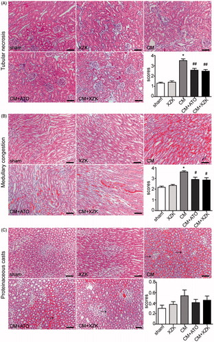 Figure 2. Histological changes of renal tissue in study groups (H&E staining, scale bar, 100 μm). (A) Tubular necrosis. Tubular necrosis was graded as follows: no damage (0), mild (1, patchy isolated damage), moderate (2, damage less than 25%), severe (3, damage between 25 and 50%), and very severe (4, more than 50% damage). (B) Medullary congestion, The degree of medullary congestion was defined as follows: no congestion (0), mild (1, vascular congestion with identification of erythrocytes by ×400 magnification), moderate (2, vascular congestion with identification of erythrocytes by ×200 magnification), severe (3, vascular congestion with identification of erythrocytes by ×100 magnification) and very severe (4, vascular congestion with identification of erythrocytes by ×40 magnification). (C) Proteinaceous casts. Proteinaceous casts were graded as follows: no damage (0), mild (1, unicellular, patchy isolated damage), moderate (2, damage less than 25%), severe (3, damage between 25 and 50%), and very severe (4, more than 50% damage). *p < 0.01 versus group sham and group XZK; #p < 0.05, ##p < 0.01 versus group CM. n = 10. Values are mean ± SEM.