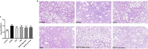 Figure 1 Effect of QGYD on mice infected with CRPA. Mice were infected with CRPA intranasally. Six groups of mice were simultaneously treated orally with QGYD low- and high-dose (40 and 20 g·kg−1·d−1), LEV (0.09 g·kg−1·d−1), IPM (0.55 g·kg−1·d−1) or distilled water (control and model group) for 4 days. On day 5 after infection, the lungs of the mice were collected for lung index (a) and lung pathological analysis ((b), ×100, n=4). Result of lung index was expressed as mean ±SD (n = 8), and compared with the model group, **p < 0.01, ***p < 0.001, ****p < 0.0001.