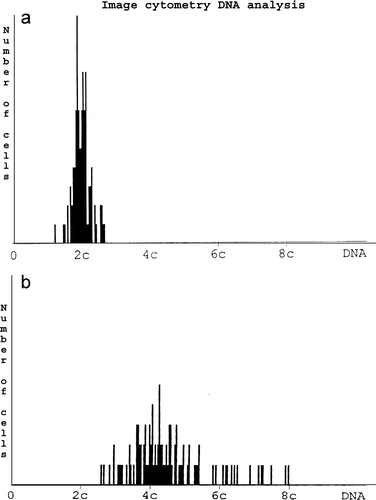 Figure 1.  Diploid cell population, b. Aneuploid cell population by image cytometry.