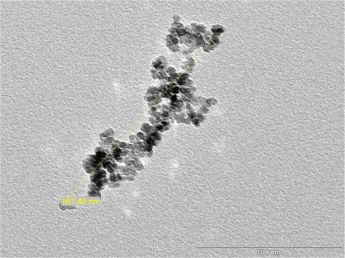 Figure 1 HRTEM image of UL-Ds’ iron core.Notes: The bar shows the scale in nm and the yellow line shows the size of the nanoparticle aggregate.Abbreviations: HRTEM, high-resolution transmission electron microscopy; UL-Ds, University of Luebeck-Dextran coated superparamagnetic nanoparticles.