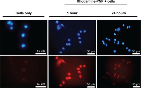 Figure 3 Fluorescence images show that Rhodamine-PNP were internalized in MiaPaCa-2 pancreatic cancer cells following 1 hour and 24 hours of treatment of the cells. Cells were visualized by detecting a 4′,6-diamidino-2-phenylindole (DAPI) stain (top), and Rhodamine-labeled PNP were visualized by detecting Rhodamine (bottom).Abbreviation: PNP, poly(lactic-co-glycolic acid) polymeric nanoparticles.