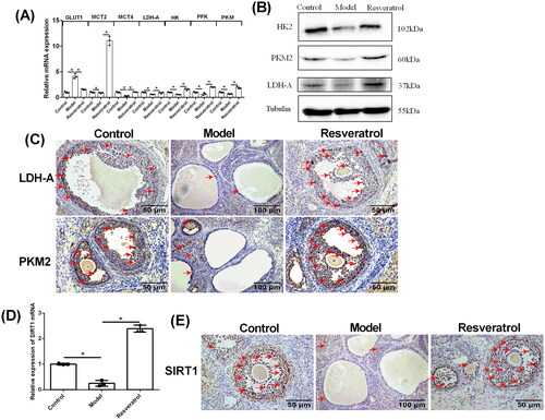 Figure 6. Effects of resveratrol treatment on the PKM2, LDH-A, and SRIT1 expression levels in the ovarian tissues from PCOS rats. (A) The mRNA expression levels of GLUT1, MCT2, MCT4, LDH-A, HK, PFK, and PKM in control rats, PCOS rats, and resveratrol-treated PCOS rats were determined by qRT-PCR. (B) The protein expression of HK2, PKM2, and LDH-A in control rats, PCOS rats and resveratrol-treated PCOS rats was determined by western blot assay. (C) The protein expression levels of LDH-A and PKM2 in control rats, PCOS rats, and resveratrol-treated PCOS rats was determined by IHC. (D) The mRNA expression levels of SIRT1 in control rats, PCOS rats, and resveratrol-treated PCOS rats was determined by qRT-PCR. (E) The protein expression levels of SIRT1 in control rats, PCOS rats, and resveratrol-treated PCOS rats was determined by IHC. Red arrows indicated the positively stained cells. N = 6; *p < 0.05 indicated the significant different between different treatment groups.