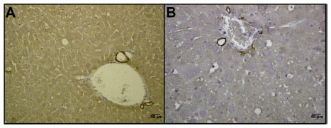 Figure S1 Keratin 18 staining in normal liver identifies sites of probable tumor origin.