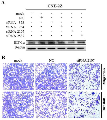 Figure 3. Knock-down of HIF-1α with siRNA protected against 1g inhibited migration and invasion in CNE-2Z cells. (a) The cells were transfected with HIF-1α siRNA, and whole cell lysates were subjected to western blotting analysis. (b) Transwell assay was used to detect cell migration and invasion after 24 h transfection with HIF-1α siRNA (original magnification 200×).