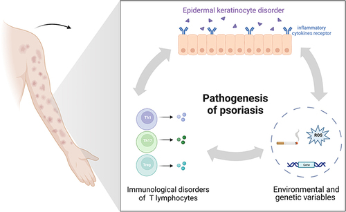 Figure 1 The pathogenesis of psoriasis.