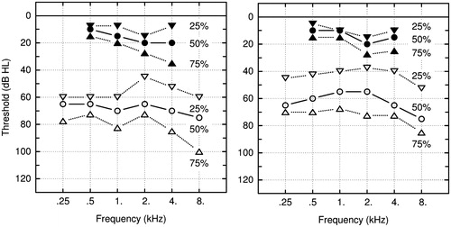 Figure 1. Left and right pure-tone thresholds of the 19 subjects for bone conduction (filled symbols) and air conduction (open symbols), expressed in 25-, 50-, and 75-percentiles and shown with downward pointing triangles, circles and upward pointing triangles, respectively.