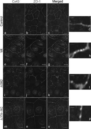Figure 4 Subcellular localization of Cx43 and ZO-1 in MDCK cells. Untransfected MDCK cells lacking Cx43wt and MDCK cell clones expressing Cx43wt, Cx43ΔI382, or Cx43Δ378–382 were plated on glass coverslips, fixed in methanol, and stained for Cx43 using a rabbit polyclonal antibody (Cx43 panels, CT368 green) and costained for ZO-1 using a rat monoclonal antibody (ZO-1 panels, R26.4C red). Merged images of Cx43 and ZO-1 are shown in the panels at the far right (merged panels). Scale bars for these panels represent 3.2 μ m. Significant areas of colocalization (orange or yellow color) are shown in the boxes in the merged panels. Enlargement of the boxed areas are shown in panels d, h, l, and p. Scale bars for the enlarged images represent 300 nm. (See Color Plate II at the end of this issue)