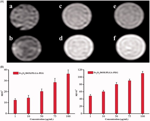 Figure 5. (A) MRI image of different concentrations of Fe3O4/DOX/PLGA-PEG. (B) R2 and R2* relaxometry rates of different concentrations of Fe3O4/DOX/PLGA-PEG nanoparticles.