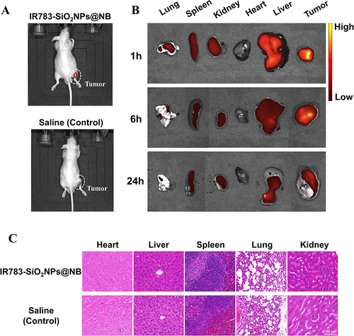 Figure 7 (A) The in vivo tumor tissue accumulation of IR783-SiO2NPs@NB (up) and saline (down) at 1 hour evaluated by NIRF imaging. (B) Ex vivo fluorescence imaging of the lung, spleen, kidney, heart, liver, and tumor at different time points after IR783-SiO2NPs@NB injection. (C) H&E staining was conducted on heart, kidney, liver, spleen, and lung sections of nude mice injected with IR783-SiO2NPs@NB (up) and saline (down).
