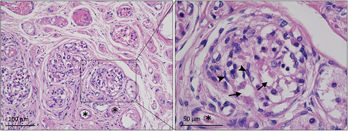 Figure 3. CB section from xylene cleared specimen II stained with H & E. Many vascular structures (*) are evident surrounded by clusters of large type I/glomus cells containing vesicles (arrow). The glomus cells in turn are surrounded by smaller type II/satellite or sustentacular cells with elongated nuclei (arrowhead).