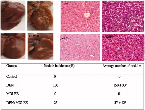 Figure 2. Effect of MOLEE on hepatic morphology, histology (HE staining, ×200) and changes of nodule incidence and average number of nodules per nodule-bearing liver in rats. The data are presented as the mean ± S.E. (p < 0.05).