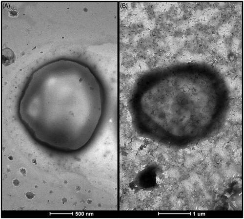 Figure 1. Transmission electron micrographs of A: uncoated liposomes (F3), B: chitosan-coated liposomes (F3C).
