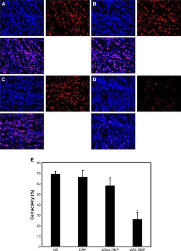 Figure 9 Cell proliferation detection.Notes: Cell proliferation was assessed by counting the number of Ki67-positive cells in the field (five high-power fields per slide), and DMP–Gli1si was superior to other controls in inhibiting cell proliferation. DMP–Gli1si significantly inhibited cell proliferation, (E) mean Ki67-positive cells every five fields; *p<0.05, DMP–Gli1si (D) vs NS (A), DMP (B), DMP–Consi (C).Abbreviations: DMP, 1,2-dioleoyl-3-trimethylammonium-propane and methoxy poly(ethylene glycol)-poly(lactide) copolymer; NS, normal salt.